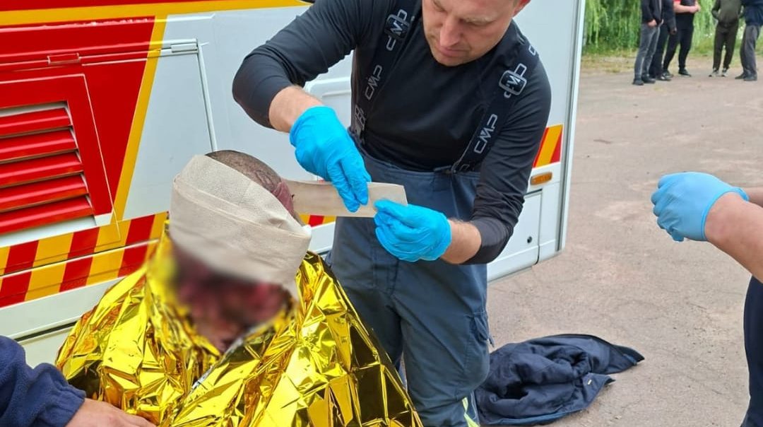 На Житомирщині внаслідок російської атаки на агропідприємство постраждали шестеро людей, серед них троє дітей
